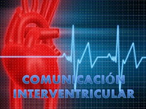 Comunicación Interventricular