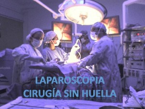 LAPAROSCOPIA