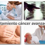 Tratamiento de cáncer avanzado