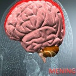 Meningitis