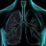 EPOC: La enfermedad pulmonar obstructiva crónica