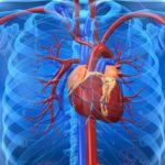 Cardiopatía Isquémica: síntomas, causas y tratamiento