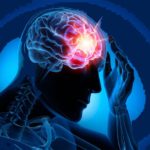 Epilepsia: conoce su origen y causas