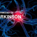 La enfermedad de Parkinson