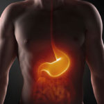 Síntomas de la acidez estomacal o ardor de estómago