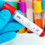 Avances en los tratamientos del VIH